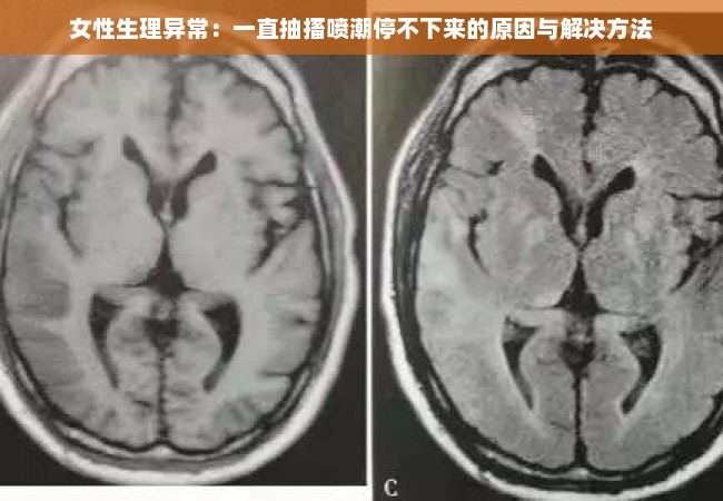 女性生理异常：一直抽搐喷潮停不下来的原因与解决方法